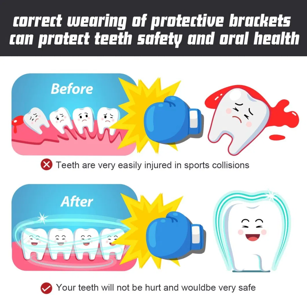 Sportl Mouth Guard for Football, Boxing, Youth &amp; Adult